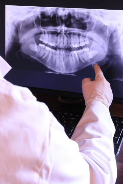 Best Emergency Tooth Extraction in Talahi Island, GA
